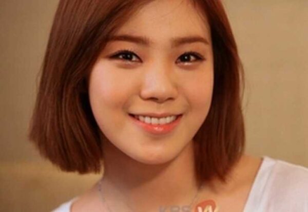 韓国アイドル(k-pop)整形デビュー前と後のビフォーアフター紹介！成功してる？